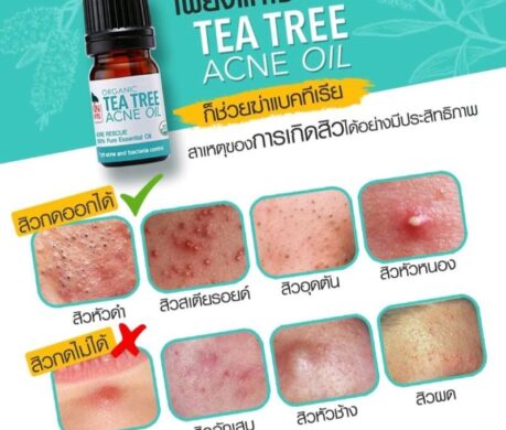 messageImage_1687861790674 459x390