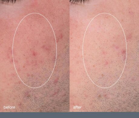 messageImage_1688027098675 459x390