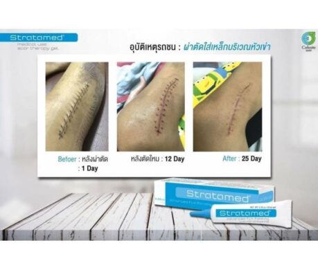 messageImage_1688103025467 459x390