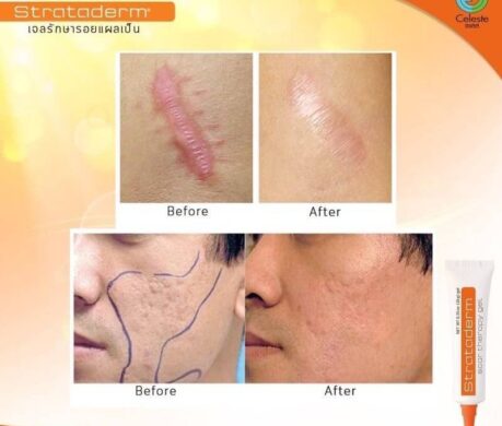 messageImage_1688103036807 459x390